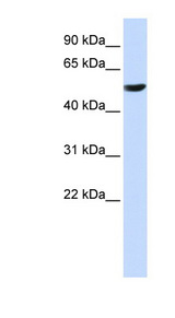 CYB561 antibody LS-C110657 Western blot of HeLa lysate.