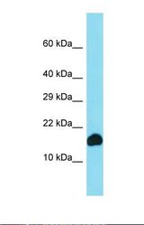 Western blot of Human COLO205. CYB561D1 antibody dilution 1.0 ug/ml.