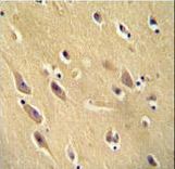 CYB561D1 antibody immunohistochemistry of formalin-fixed and paraffin-embedded human brain tissue followed by peroxidase-conjugated secondary antibody and DAB staining.