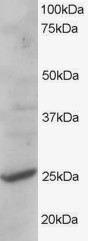 Antibody staining (1 ug/ml) of human liver lysate (RIPA buffer, 35 ug total protein per lane). Primary incubated for 1 hour. Detected by Western blot of chemiluminescence.