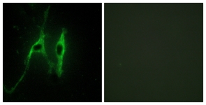 Immunofluorescence of NIH-3T3 cells, using CYB5 Antibody. The picture on the right is treated with the synthesized peptide.