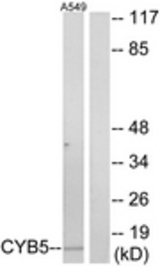Western blot of extracts from A549 cells, using CYB5 Antibody. The lane on the right is treated with the synthesized peptide.