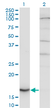 Western blot of CYB5A expression in transfected 293T cell line by CYB5A monoclonal antibody.