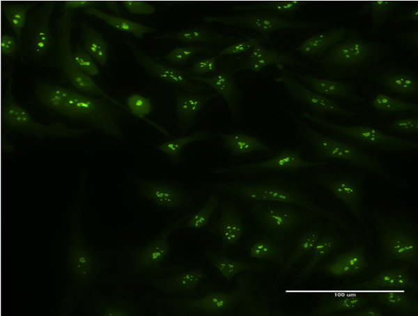 Immunofluorescence of monoclonal antibody to CIRBP on HeLa cell . [antibody concentration 10 ug/ml]