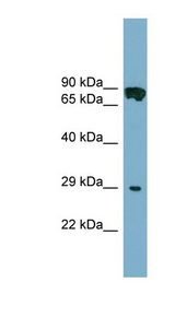 CYB5D1 antibody LS-C111419 Western blot of COLO205 cell lysate.