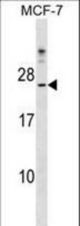 CYB5D1 Antibody western blot of MCF-7 cell line lysates (35 ug/lane). The CYB5D1 antibody detected the CYB5D1 protein (arrow).