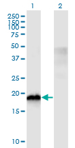 Western Blot analysis of CIRBP expression in transfected 293T cell line by CIRBP monoclonal antibody (M03), clone 1C9.Lane 1: CIRBP transfected lysate (Predicted MW: 18.6 KDa).Lane 2: Non-transfected lysate.