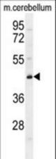 CYB5D2 Antibody western blot of mouse cerebellum tissue lysates (35 ug/lane). The CYB5D2 antibody detected the CYB5D2 protein (arrow).