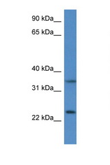 CYB5R1 antibody LS-C145216 Western blot of Mouse Thymus lysate. Antibody concentration 1 ug/ml.