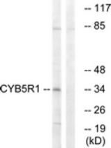 Western blot of extracts from RAW264.7 cells, using CYB5R1 Antibody. The lane on the right is treated with the synthesized peptide.
