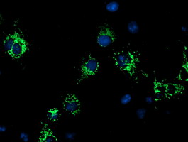 Anti-CYB5R1 mouse monoclonal antibody immunofluorescent staining of COS7 cells transiently transfected by pCMV6-ENTRY CYB5R1.