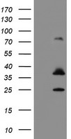HEK293T cells were transfected with the pCMV6-ENTRY control (Left lane) or pCMV6-ENTRY CYB5R1 (Right lane) cDNA for 48 hrs and lysed. Equivalent amounts of cell lysates (5 ug per lane) were separated by SDS-PAGE and immunoblotted with anti-CYB5R1.