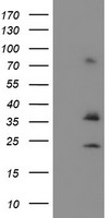 HEK293T cells were transfected with the pCMV6-ENTRY control (Left lane) or pCMV6-ENTRY CYB5R1 (Right lane) cDNA for 48 hrs and lysed. Equivalent amounts of cell lysates (5 ug per lane) were separated by SDS-PAGE and immunoblotted with anti-CYB5R1.