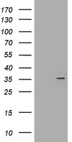 HEK293T cells were transfected with the pCMV6-ENTRY control (Left lane) or pCMV6-ENTRY CYB5R1 (Right lane) cDNA for 48 hrs and lysed. Equivalent amounts of cell lysates (5 ug per lane) were separated by SDS-PAGE and immunoblotted with anti-CYB5R1.