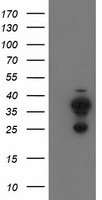 HEK293T cells were transfected with the pCMV6-ENTRY control (Left lane) or pCMV6-ENTRY CYB5R2 (Right lane) cDNA for 48 hrs and lysed. Equivalent amounts of cell lysates (5 ug per lane) were separated by SDS-PAGE and immunoblotted with anti-CYB5R2.