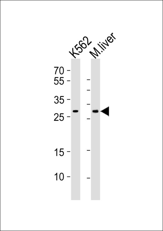 Western blot of lysates from K562 cell line, mouse liver tissue lysate (from left to right) with CYB5R2 Antibody. Antibody was diluted at 1:1000 at each lane. A goat anti-rabbit IgG H&L (HRP) at 1:10000 dilution was used as the secondary antibody. Lysates at 35 ug per lane.