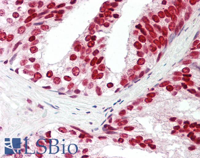 Human Prostate: Formalin-Fixed, Paraffin-Embedded (FFPE)