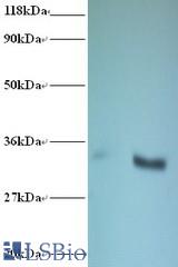 Western blot of NADH-cytochrome b5 reductase 3 antibody at 2 ug/ml. Lane 1: EC109 whole cell lysate. Lane 2: 293T whole cell lysate. Secondary: Goat polyclonal to Rabbit IgG at 1:15000 dilution. Predicted band size: 33 kDa. Observed band size: 33 kDa.