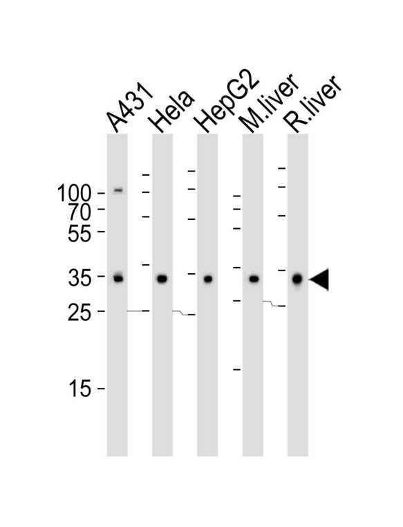 Western blot of lysates from A431, HeLa, HepG2 cell line , mouse liver and rat liver tissue lysate (from left to right) with CYB5R3 Antibody. Antibody was diluted at 1:1000 at each lane. A goat anti-rabbit IgG H&L (HRP) at 1:5000 dilution was used as the secondary antibody. Lysates at 35 ug per lane.