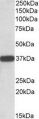 CYB5R3 antibody (0.01 ug/ml) staining of Human Umbilical Cord lysate (35 ug protein/ml in RIPA buffer). Primary incubation was 1 hour. Detected by chemiluminescence.