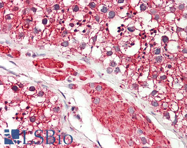 Anti-CYB5R3 / B5R antibody IHC staining of human testis. Immunohistochemistry of formalin-fixed, paraffin-embedded tissue after heat-induced antigen retrieval. Antibody LS-B11358 concentration 20 ug/ml.