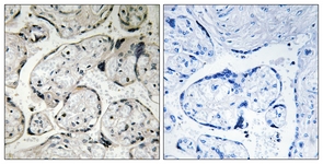 IHC of paraffin-embedded human placenta tissue, using CYB5R3 Antibody. The picture on the right is treated with the synthesized peptide.