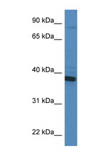 CYB5R3 antibody LS-C135894 Western blot of HT1080 Cell lysate. Antibody concentration 1 ug/ml.