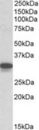 CYB5R3 antibody (0.1 ug/ml) staining of Mouse Lung lysate (35 ug protein/ml in RIPA buffer). Primary incubation was 1 hour. Detected by chemiluminescence.