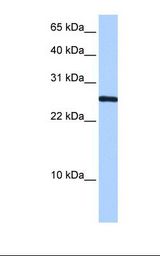 HepG2 cell lysate. Antibody concentration: 0.5 ug/ml. Gel concentration: 15%.