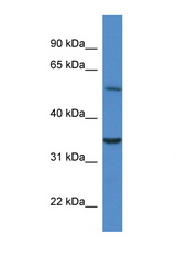 CYB5R4 antibody LS-C135412 Western blot of Mouse Pancreas lysate. Antibody concentration 1 ug/ml.