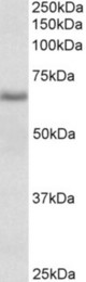 CYB5R4 antibody (0.1 ug/ml) staining of Rat Spleen lysate (35 ug protein in RIPA buffer). Primary incubation was 1 hour. Detected by chemiluminescence.