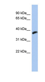 CYB5RL antibody LS-C111852 Western blot of HT1080 cell lysate.