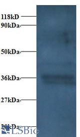 Western blot of Cytochrome c1, heme protein, mitochondrial Antibody at 2 ug/ml + EC109 whole cell lysate at 20 ug. Secondary: Goat polyclonal to Rabbit IgG at 1:15000 dilution. Predicted band size: 36 kDa. Observed band size: 36 kDa.