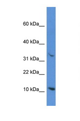 CYCS / Cytochrome c antibody LS-C145650 Western blot of OVCAR-3 Cell lysate. Antibody concentration 1 ug/ml.