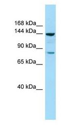 CYFIP1 antibody Western Blot of COLO205.