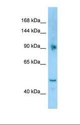 Western blot of Human ACHN. CYFIP1 antibody dilution 1.0 ug/ml.