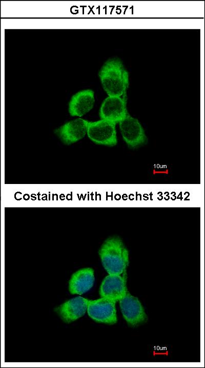Immunofluorescence of methanol-fixed A431, using Cytoglobin antibody at 1:500 dilution.