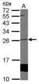 Sample (50 ug of whole cell lysate) A: mouse heart 12% SDS PAGE CYGB / Cytoglobin antibody diluted at 1:1000