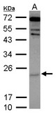 Sample (30 ug of whole cell lysate) A: IMR32 12% SDS PAGE CYGB / Cytoglobin antibody diluted at 1:2000