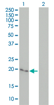 Western blot of CYGB expression in transfected 293T cell line by CYGB monoclonal antibody (M02), clone 1A1.