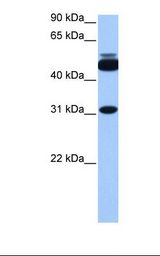 721_B cell lysate. Antibody concentration: 1.0 ug/ml. Gel concentration: 12%.