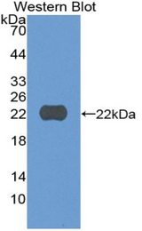Western blot of recombinant CYLD.