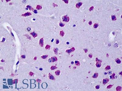 Anti-CYLD antibody IHC of mouse brain. Immunohistochemistry of formalin-fixed, paraffin-embedded tissue after heat-induced antigen retrieval. Antibody LS-B4323 concentration 5 ug/ml.