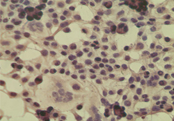 ICC staining of HeLa cell using control (rabbit Ig) at 5 ug/ml.