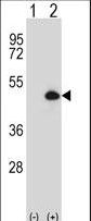 Western blot of CYP20A1 (arrow) using rabbit polyclonal CYP20A1 Antibody. 293 cell lysates (2 ug/lane) either nontransfected (Lane 1) or transiently transfected (Lane 2) with the CYP20A1 gene.