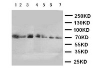 WB of CYP11B1 antibody. Lane 1: HELA Cell Lysate. Lane 2: U87 Cell Lysate. Lane 3: M231 Cell Lysate. Lane 4: PANC Cell Lysate. Lane 5: M453 Cell Lysate. Lane 6: HELA Cell Lysate. Lane 7: SMMC Cell Lysate.