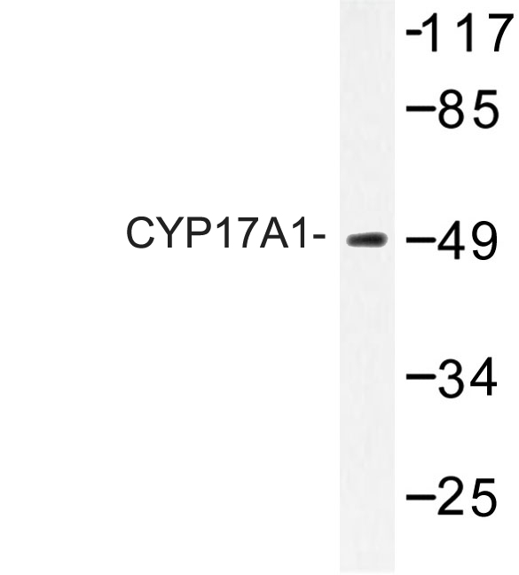 Western blot of CYP17A1 (N249) pAb in extracts from Jurkat cells.