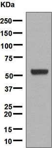 Western blot analysis on human adrenal gland lysate using anti-CYP17A1 antibody.