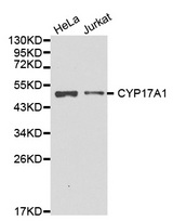 Western blot analysis of extracts of various cell lines, using CYP17A1 antibody.