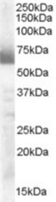 Antibody (0.3 ug/ml) staining of human ovary lysate (35 ug protein in RIPA buffer). Primary incubation was 1 hour. Detected by chemiluminescence.